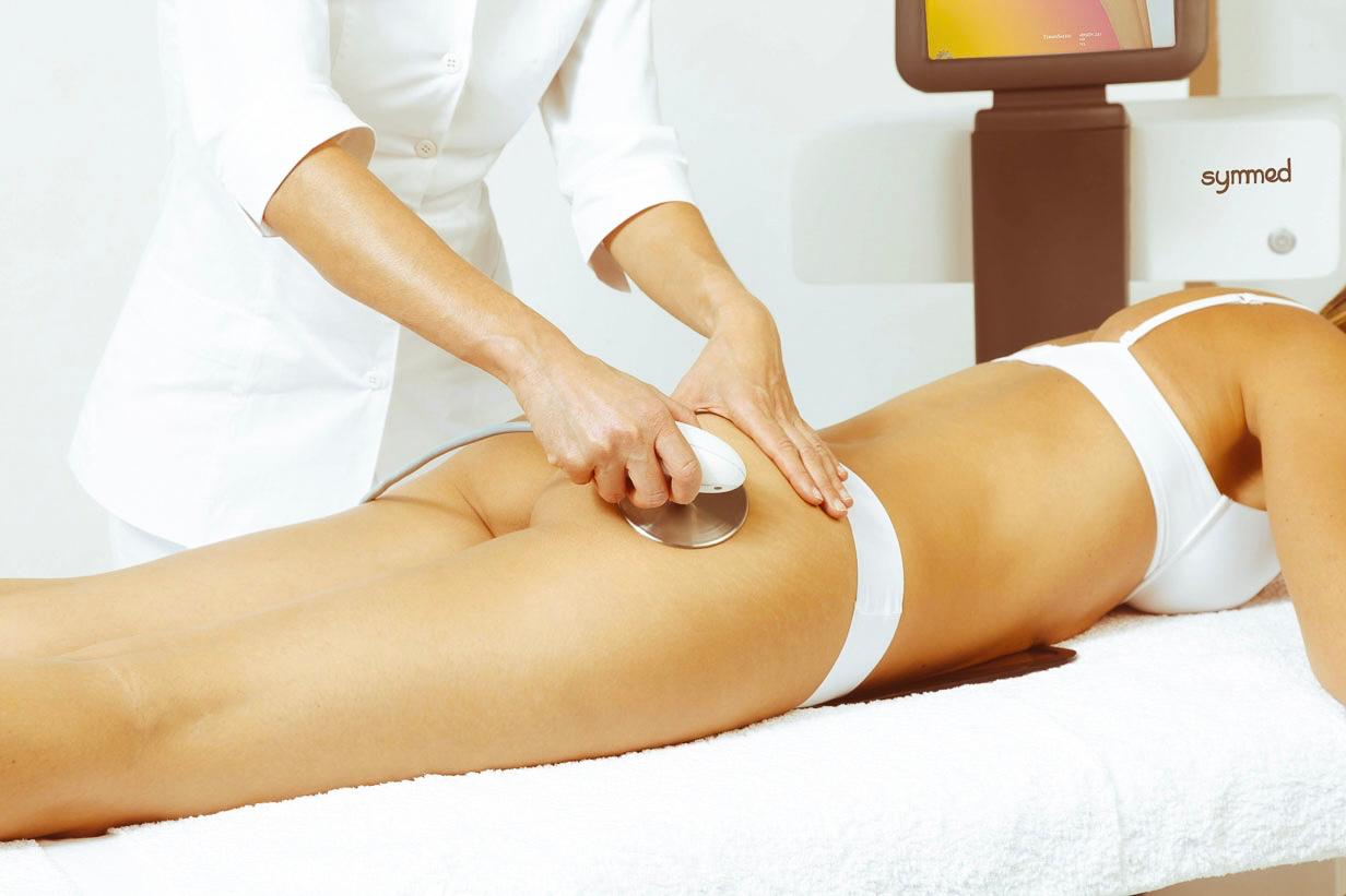 Symmed radiofrecuencia para reafirmar y definir